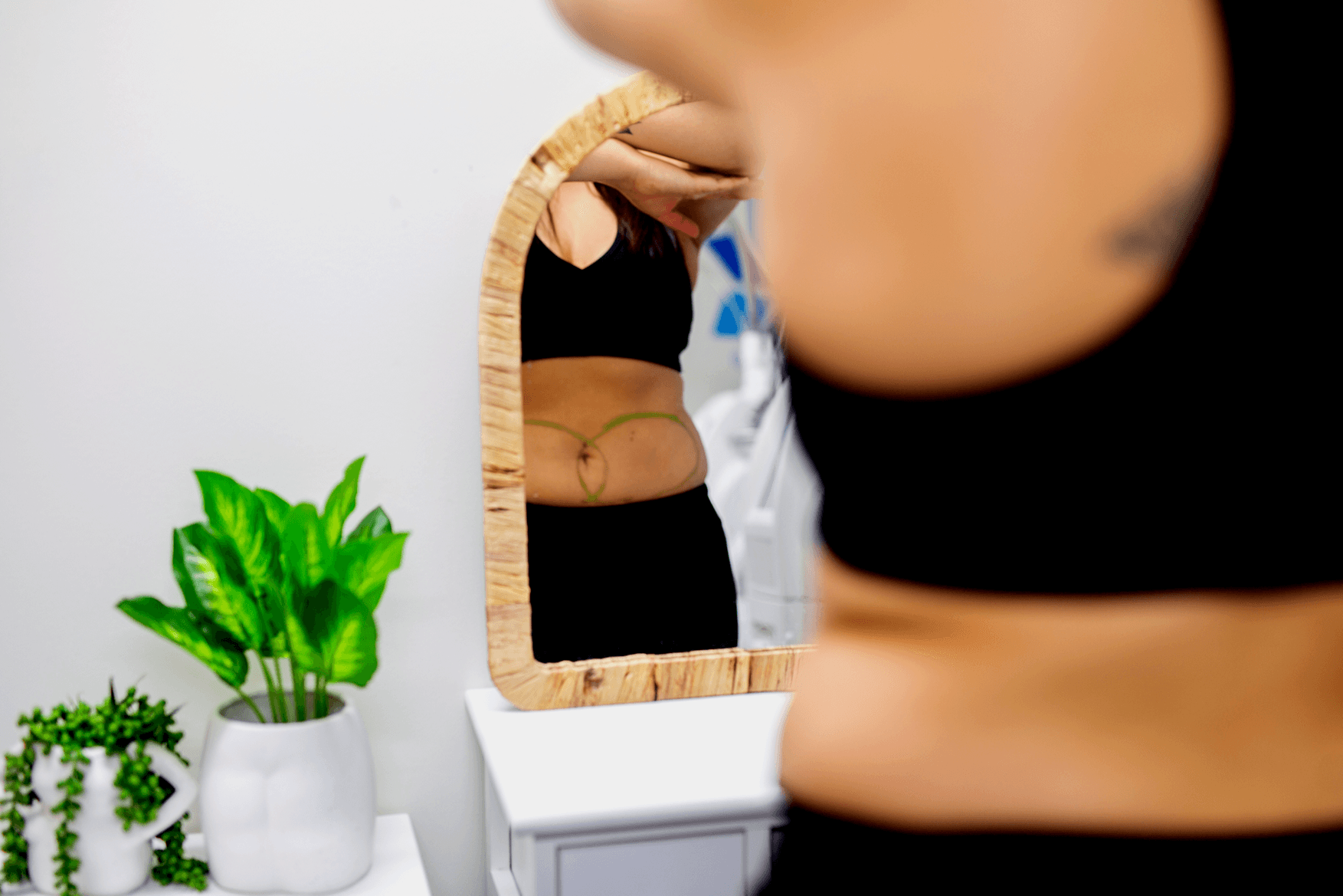 Body Sculpt Clinic patient getting prepared for treatment