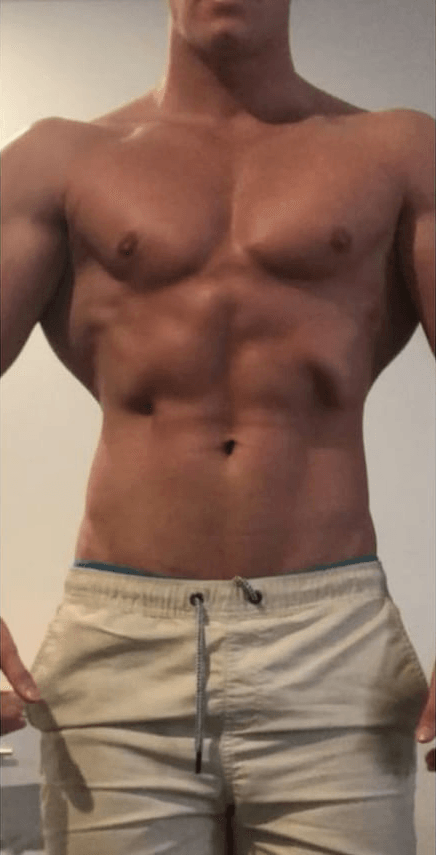 After BodySculpt treatment
